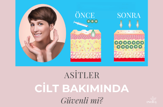 Cilt Bakımında Asitler Güvenli mi?